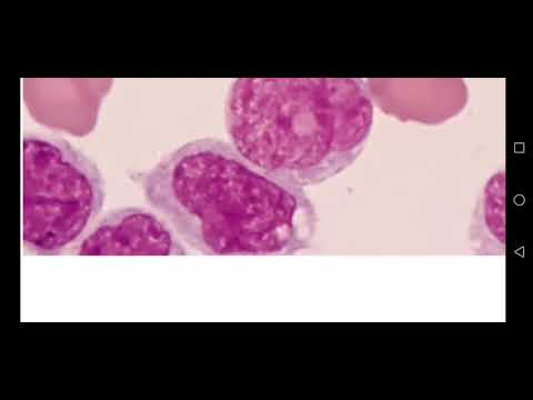 Vídeo: Papel De CD14 En Inflamación E Infección Pulmonar