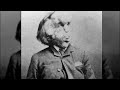 La Triste Y Trágica Historia De Joseph Merrick