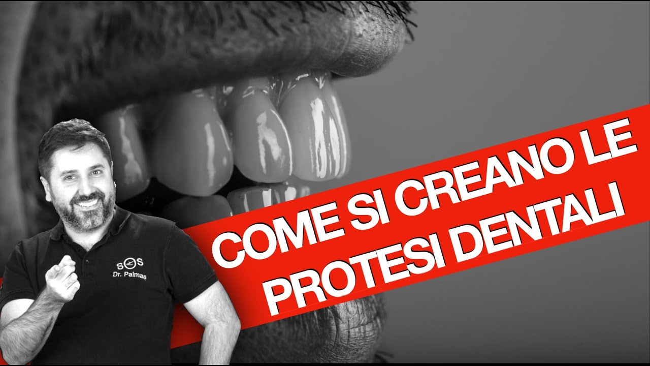 Denti fissi su impianti: Come si creano le linee dentali