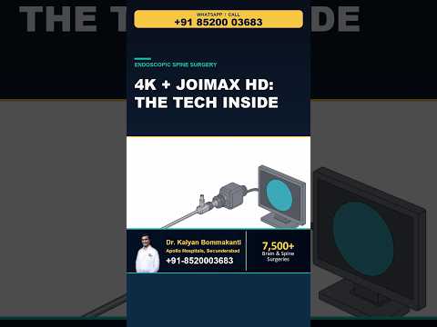 4K + Joimax HD: The Tech Inside - Best Monoportal Endoscopic Spine Surgery, Hyderabad