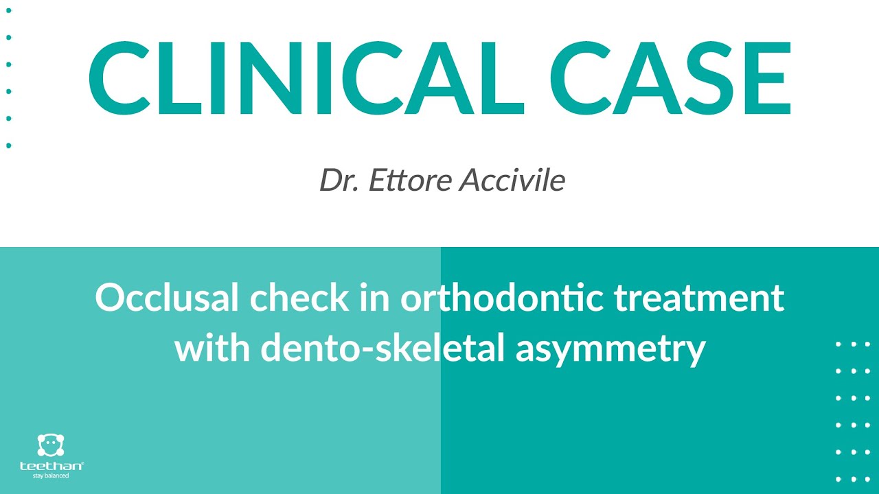 CLINICAL CASE Occlusal check in orthodontic treatment with dento