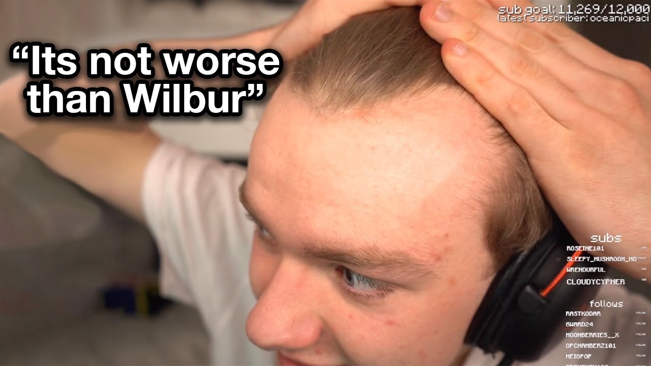 Tommy Accepts His Receding Hairline - YouTube.