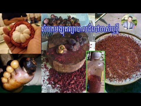 សំបកមង្ឃុត ព្យាបាលដំបៅចាស់ ឬថ្មី និងដំបៅទឹកនោមផ្អែមមានប្រសិទ្ធភាពខ្ពស់ ព្យាបាលរាគរូសរ៉ាំរ៉ៃ ការពារស្