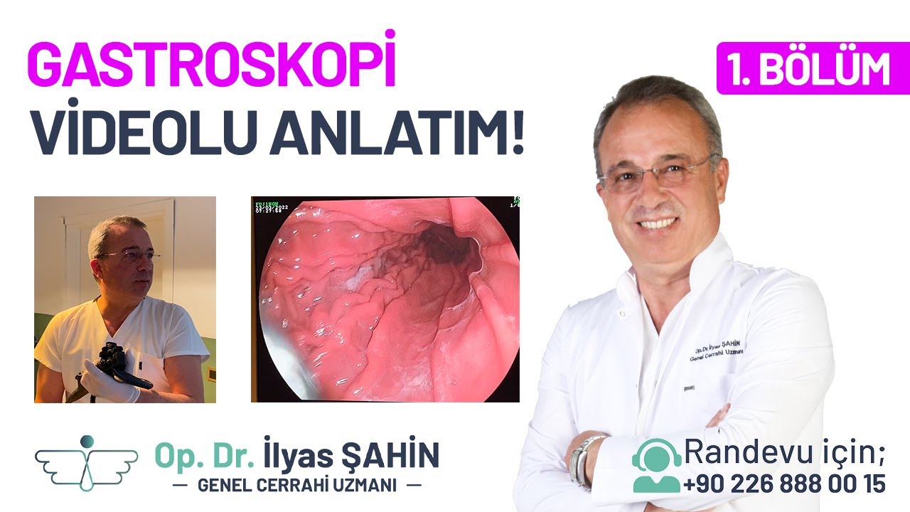 Endoskopi (Gastroskopi) İşlemi Nasıl Yapılır? Endoskopi (Gastroskopi