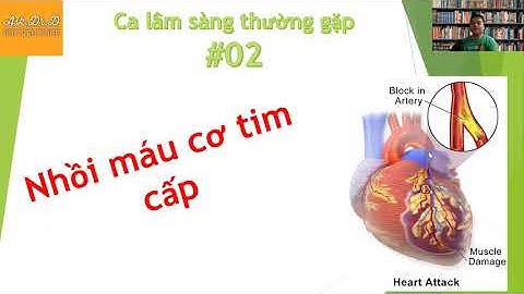 [Ca lâm sàng thường gặp #2] Tiếp cận cấp cứu nhồi máu cơ tim cấp giờ VÀNG