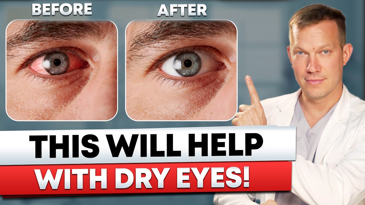 How to get rid of dry eye syndrome forever?