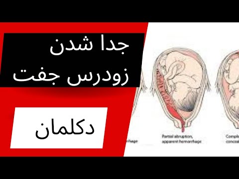 تصویری: آیا جفت خواب اسکله می‌شود؟