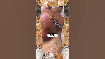 Wow Pimple Pimplepopper Pimples Shortsfeed Shortvideo Shorts Short Youtubeshorts Youtube 
