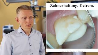 DOCTALK: Schulterchirurgie