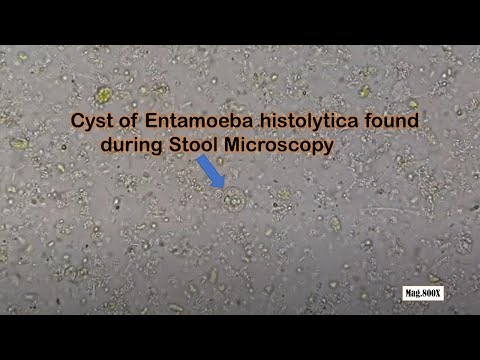 Video: Waar word entamoeba histolytica gevind?