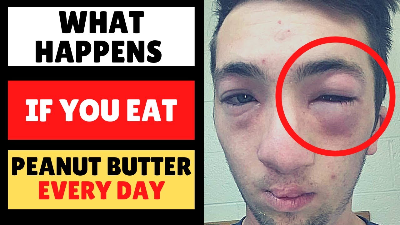 What Happens If You Eat Peanut Butter Every Day - Youtube