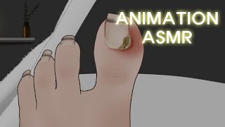 Tingle ASMR Animation!  Ingrown Toenail Removal Treatment with Stimulating Sound / LULUPANG