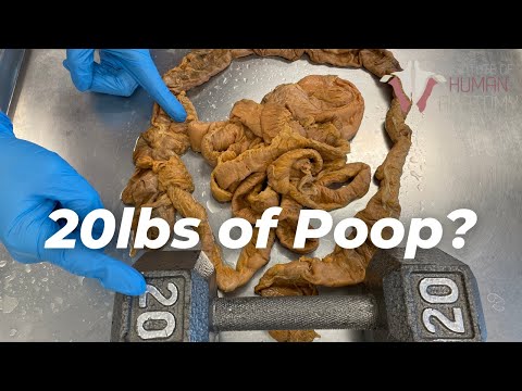 How Much Poop Is Stored in Your Colon??