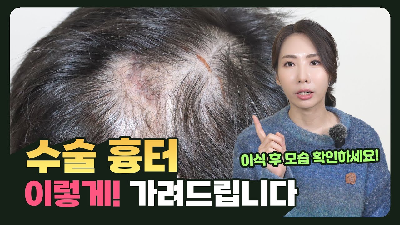 수술 흉터·함몰까지, 이렇게 가려드립니다