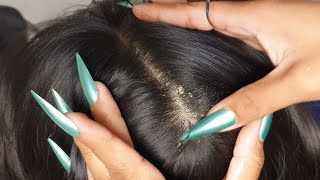 ASMR Dandruff Scalp Cleaning 🔍 | Long Hair & Pretty Nail Scratching #035