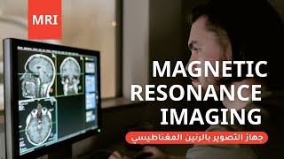 MRI - جهاز التصوير بالرنين المغناطيسي