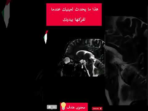 هذا ما يحدث لعينيك حينما تفركها بيديك اكسبلور  علم النفس  ترند 
