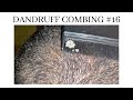 Dandruff combing #16