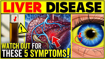 Signs That Your Liver Is Not Healthy: Don