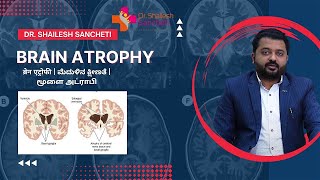 Brain Atrophy | ब्रेन एट्रोफी | ಮೆದುಳಿನ ಕ್ಷೀಣತೆ | மூளை அட்ராபி |  Cure with Homeopathy