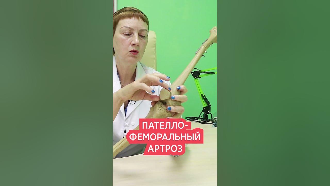 Пателлофеморальный болевой синдром это. Пателлофеморальный синдром (болевой) коленного сустава Пателлофеморальный болевой синдром коленного сустава: симптомы и лечение Пателлофеморальный болевой синдром (ПФБС) Что делать?