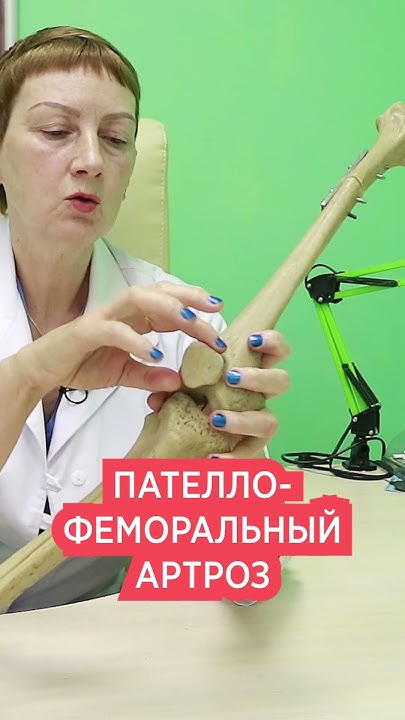 Пателлофеморальный болевой синдром это. пателлофеморальный синдром коленного сустава что это такое Пателлофеморальный артроз коленного сустава 1, 2 и 3 степени: Методы. Пателлофеморальный болевой синдром | Герммед
