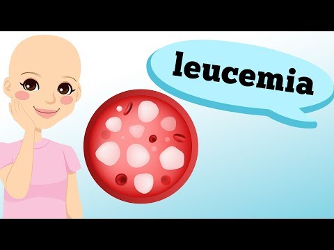 Vídeo: Onde aparecem as petéquias na leucemia?