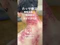 【アウフグースで仰ぎすぎた首】熱波師を整える!