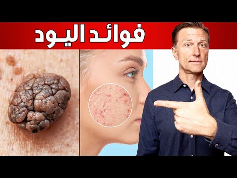 عجائب اليود أكثر من مجرد غذاء للغدة الدرقية