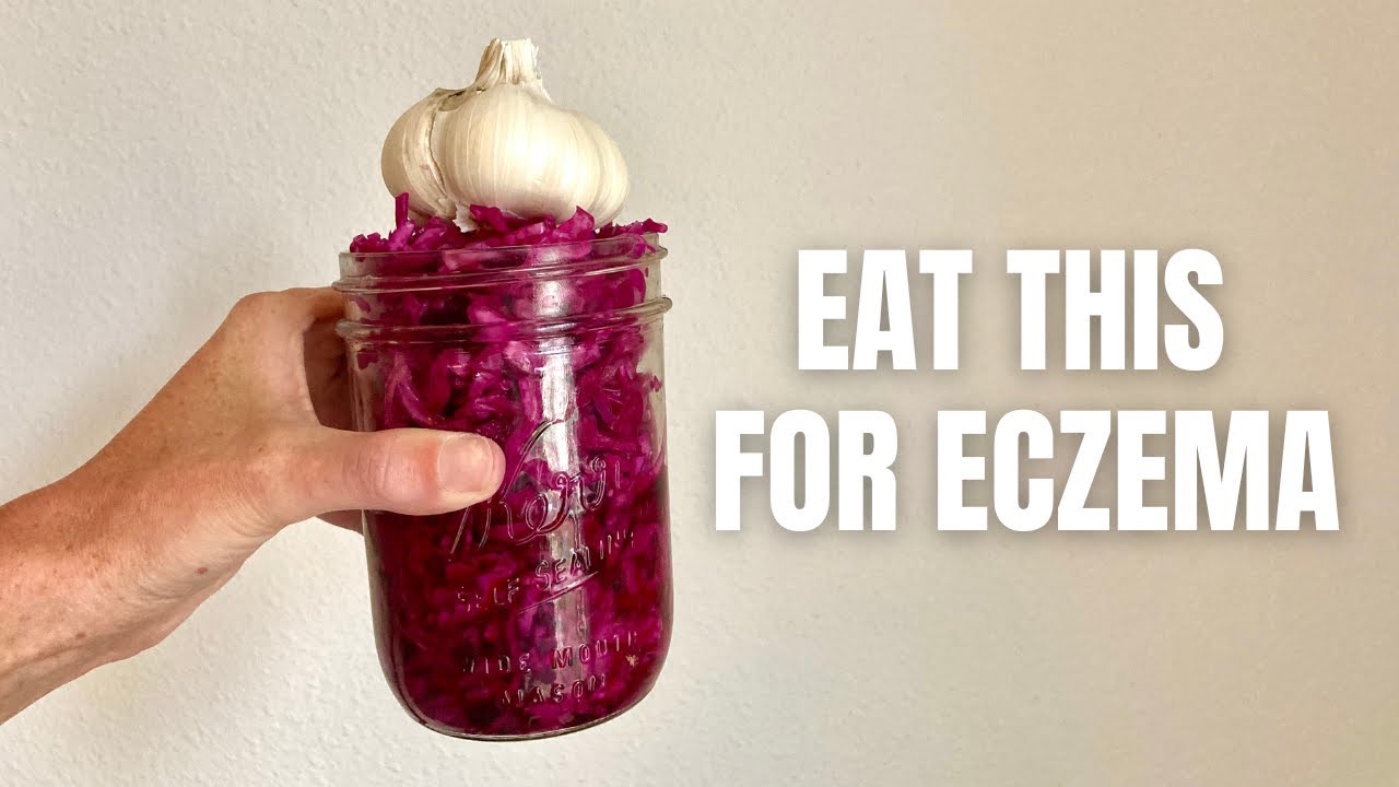 The Best Sauerkraut Recipe for Skin Health Heal Eczema with Fermented