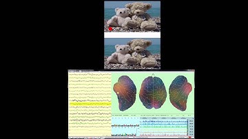 Neurocode Tracking (Quantitative EEG) and Eye Tracking Image Comparison