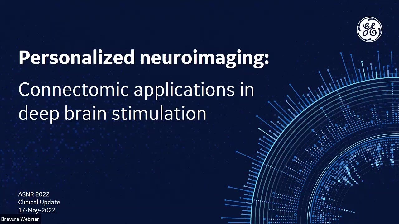 ASNR 2022 GE Personalized Neuroimaging - Connectomic Applications in Deep Brain Stimulation