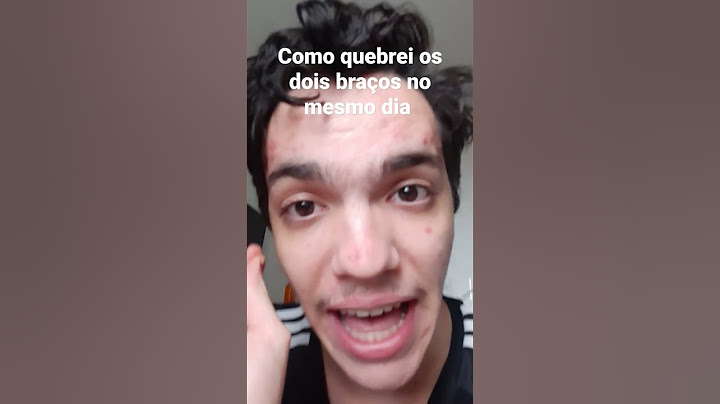 O dia que quebrei os dois braços #historia #escola #viral #shorts