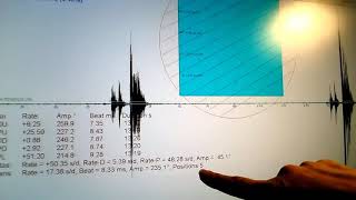 Watch Escapement Analysis - Setup