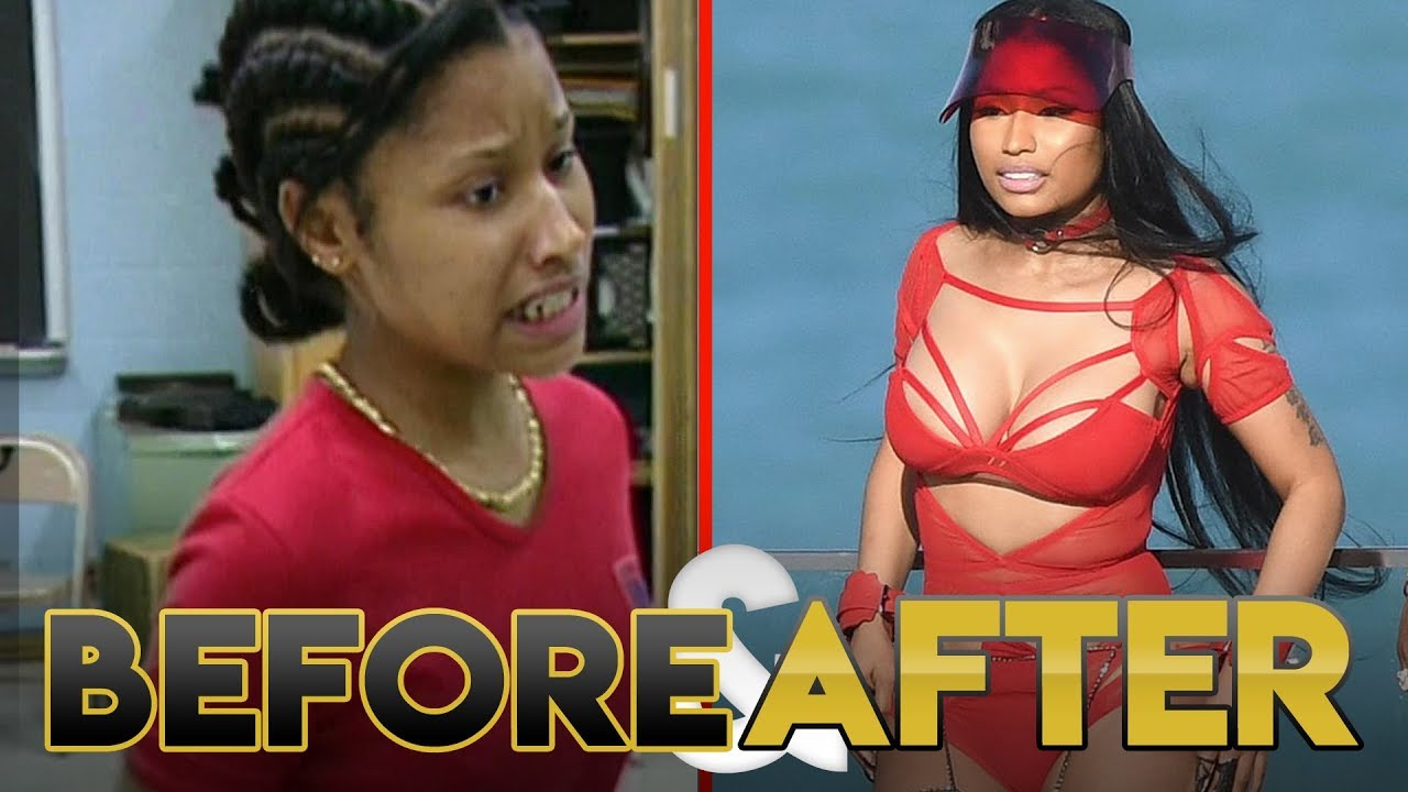 Nicki minaj before surgery