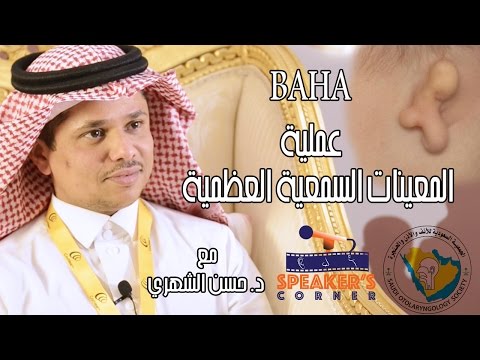 عمليات السماعات العظميه الدكتور حسن الشهري