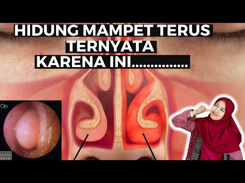 Video: Apa Gejala Distemper pada Kucing?