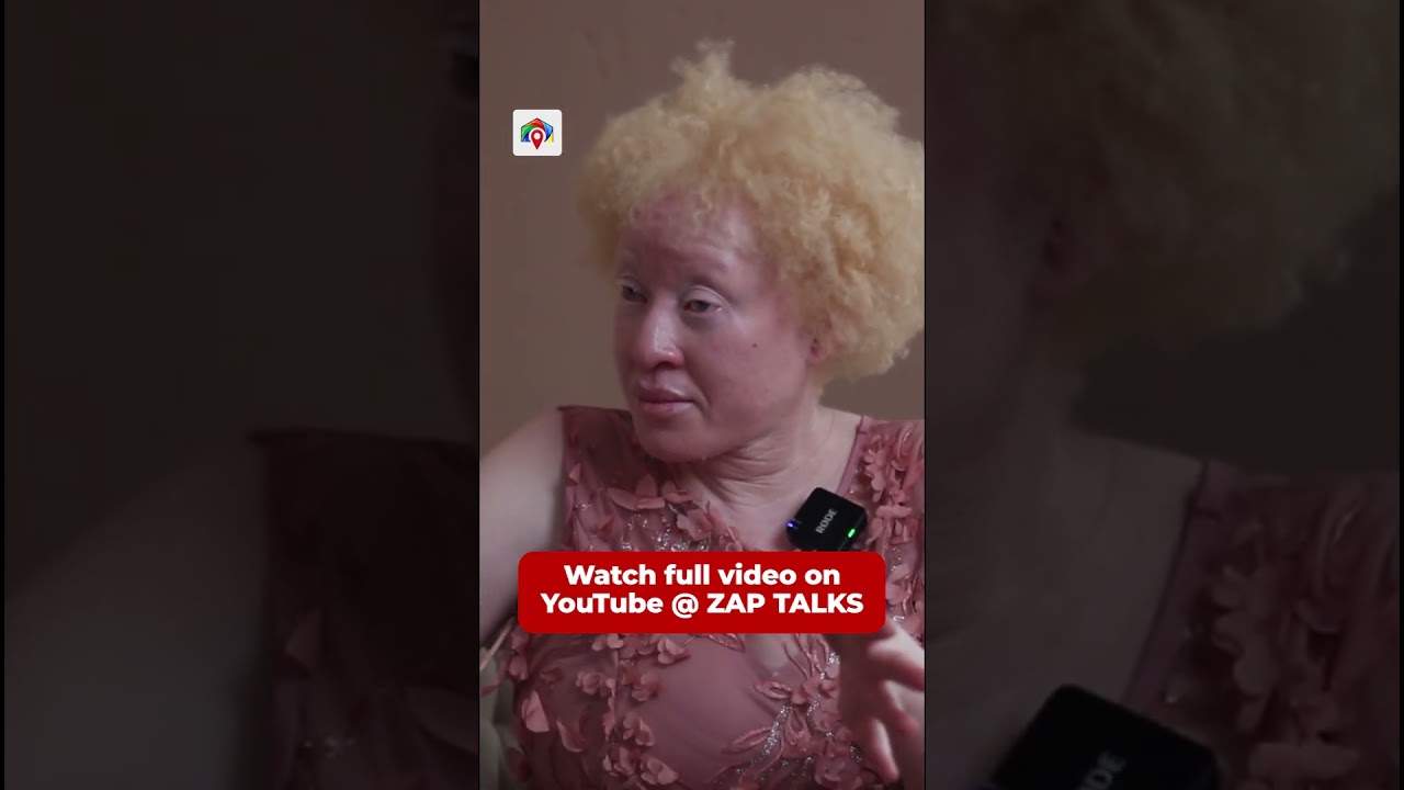 People believe Albinism can cure HIV-AIDS