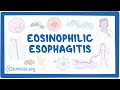 Eosinophilic esophagitis (NORD)