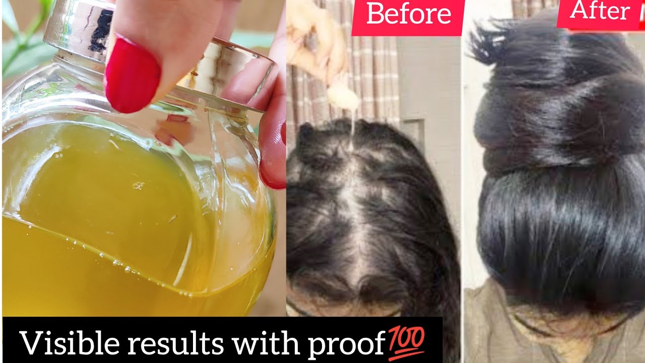 I applied👆🏼this Rosemary Hair Mix Hair Growth got TripledIncrease Hair Density, Thickness