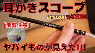 Amazonで耳かきスコープ買ったから耳かきする。鼓膜までくっきり見えた！