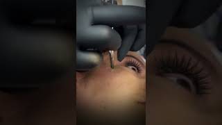 Face Dermal Piercing Would You Do This?