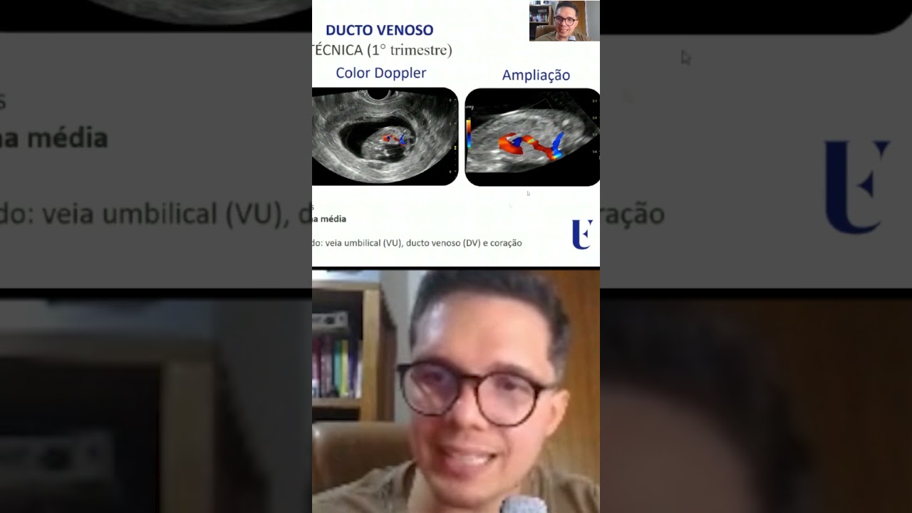 Avaliação do Ducto Venoso no Doppler obstétrico | Ultrassom obstétrico
