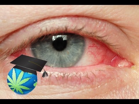 How To Get Rid of Red Eyes & High FASTER - YouTube