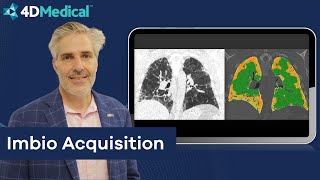 4DMedical acquires Imbio and completes equity raising