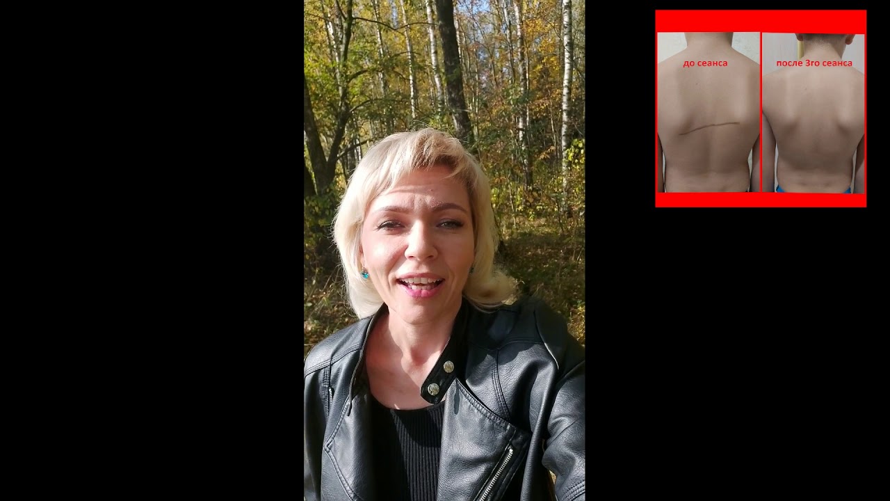 после 3 сеансы