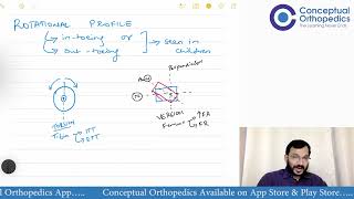 Rotational Profile of Lower Limbs by Dr. Faheem Kotekar