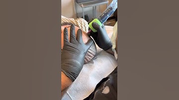 Receding Hairline Solution SMP