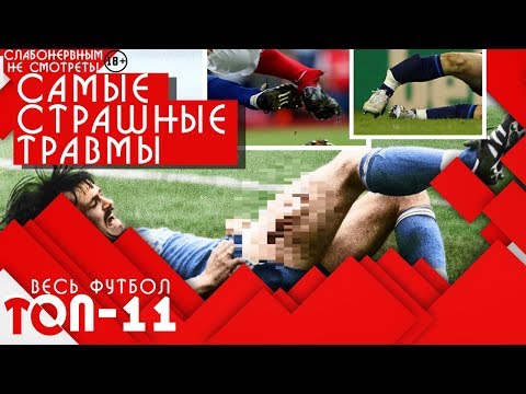 Топ 11 самых страшных травм в истории футбола