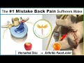 The 1 mistake most people suffering from back pain make